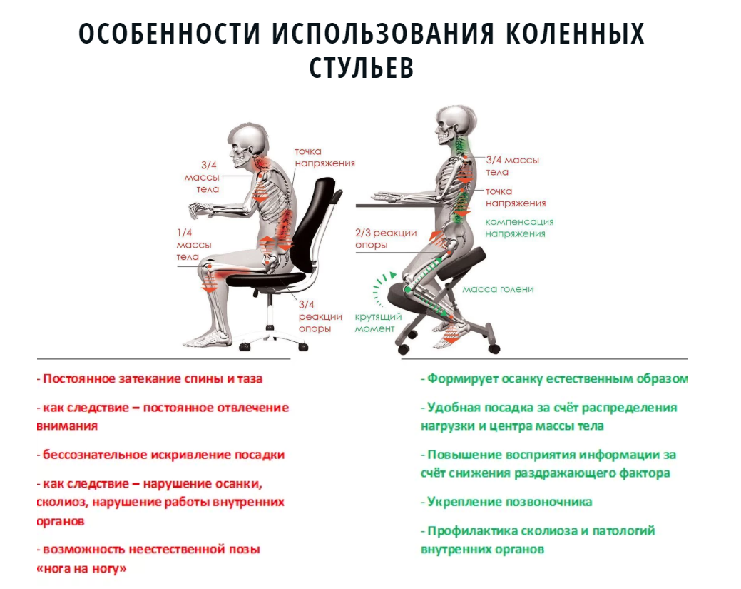 Сколько нельзя сидеть после операции. Коленный стул Yamaguchi Anatomic. Коленный стул Олимп со спинкой. Коленный регулируемый стул чертеж. Коленный стул чертеж.